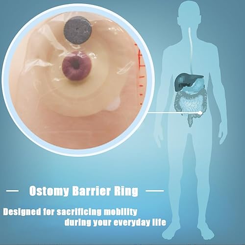 Miniatura 5 de Anillo de barrera desechable para ostomía con boquilla direccional, tira de sello cohesiva de colostomía para sistema de estoma de ileostomía,