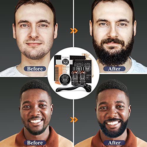 Male God Beard Growth Kit - Beard Kit With Beard Growth Oil(2 Pack), Beard Massager, Beard Balm, Beard Comb, Beard Growth Products For Patchy Beard - Fathers Day - Gifts For Men Husband Boyfriend Dad #TOP1