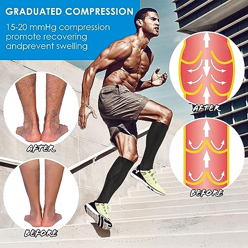 Image of cerpite Zipper Compression Socks, 2 Pairs 15-20 mmHg Closed Toe Compression Stockings for Men Women