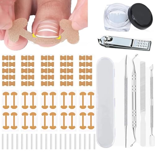 Ingrown Toenail Corrector Set with Treatment Tools & Correction Strips, Professional Pedicure Tools for Feet – Painless Ingrown Toenail Treatment and Home Care Solution for Men and Women (1Set)