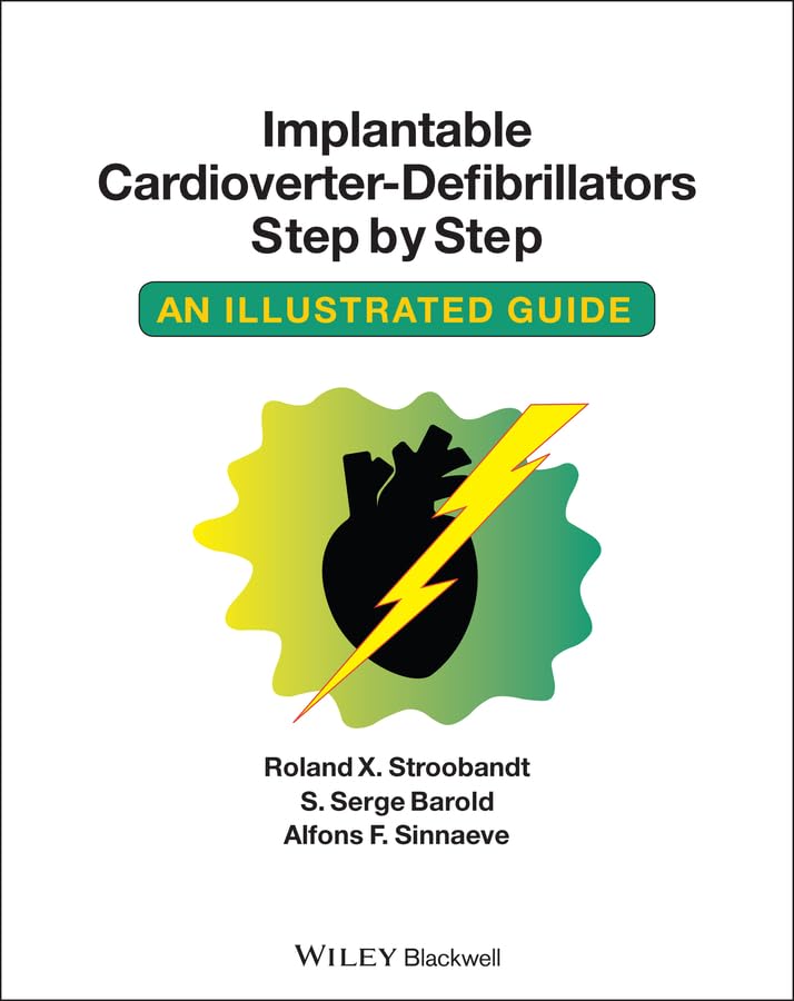 Implantable Cardioverter - Defibrillators Step by Step: An Illustrated Guide      Kindle Edition