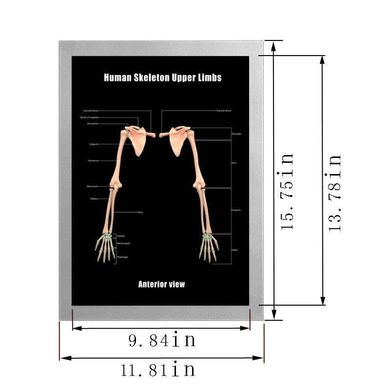 Image of Taanfu Body Educational Learning Anatomy Posters ，Skeleton Upper Limbs Art Skeleton Villi Anatomy Art Poster Digestive System Organs Illustration Small Intestine Physiology Anatomy Wall Art Villi