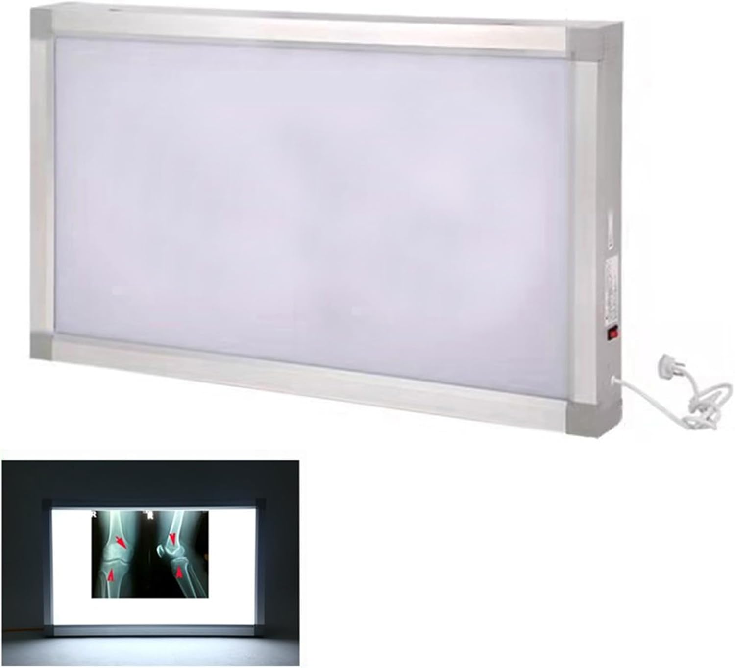 X-Ray LED Illuminator Wall Mount Film Viewer - Portable Dental Orthopaedic Slide Viewer for Medical Imaging