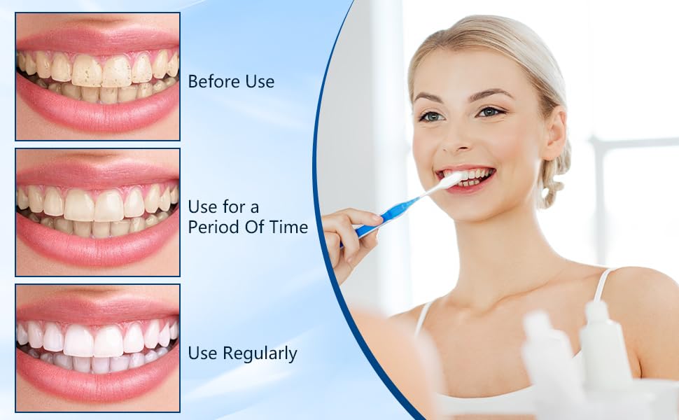 Hydroxyapatite Toothpaste,Hydroxylapatit Zahnpasta, fluoridfreie Zahnschmelzreparatur und Linderung von Zahnempfindlichkeit (4.23oz) – Bild 7