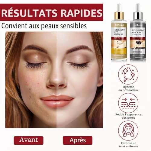 Sérum Exfoliant Visage au Riz Blanc 100ml + Riz Noir 100ml, Peeling Visage Doux AHA BHA VB3, Élimine Peaux Mortes, Affine le Grain de Peau, Réduit Pores, Éclat & Hydratation, Soin Coréen,Toute la Peau – vue 4