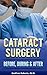 Cataract Surgery: Before, During & After: Preparing for surgery, enduring it gracefully and recovering in comfort