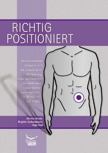 Preisvergleich Produktbild Richtig positioniert: Das präoperative Gespräch und die präoperative Markierung einer Stomaanlage zur Sicherung einer hohen Lebensqualität für Menschen mit Stoma