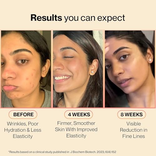Image of SETU Skin: Youthful Marine Collagen Powder (Sample Pack)|Collagen Supplements Hydrolyzed Type 1 & 3 Collagen for Healthy Skin, Hair & Nails|Peach Mango Flavor (2 Sachets), 1 count, 2 servings