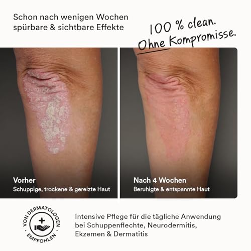 Baume apaisant naturel contre les irritations de la peau sèche 30ml neem - 6