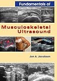 By Jon A. Jacobson - Fundamentals of Musculoskeletal Ultrasound: Expert Consult- Online and Print