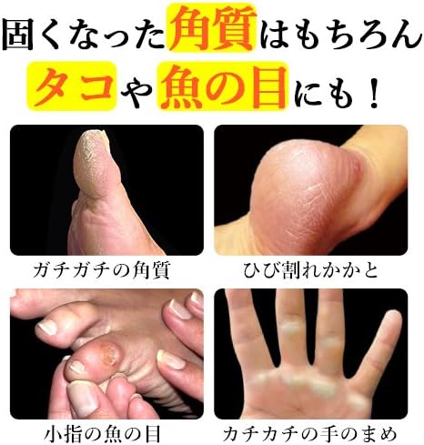 Amazon Co Jp スクラッチ まめ 角質とりスクラッチ 魚の目 タコ サポーター 芯 除去 足削る たこ 角質 スクラッチ角質取り 足 うおのめ かくしつとり 角質取り 角質除去 ドラッグストア