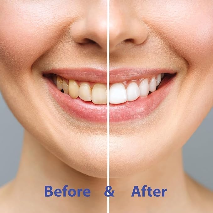 Image of Chomp Super Whitening Toothpaste Tablets, Spearmint, 60 Count | Enamel Remineralization, Reduces Tooth Sensitivity