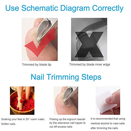 RKPM HOMES By 4Pcs Ingrown Toe Nail Clippers Tool Set, Stainless Steel Professional Ingrown or Thick Toenails Trimmer, Nail Clipper, Cuticle Fork, Nail File, Nail Cleaner Tool... - Image 7
