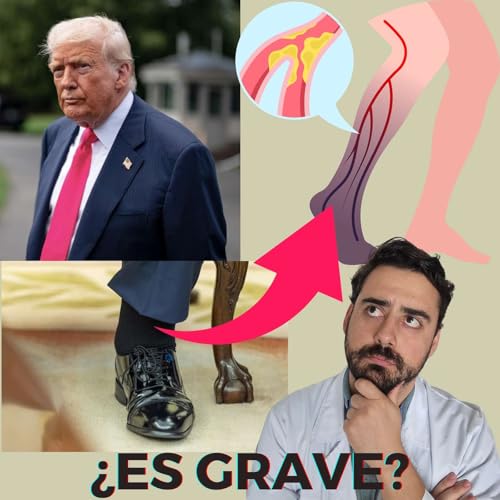 『¿La Insuficiencia Venosa de Donald Trump es grave?』のカバーアート