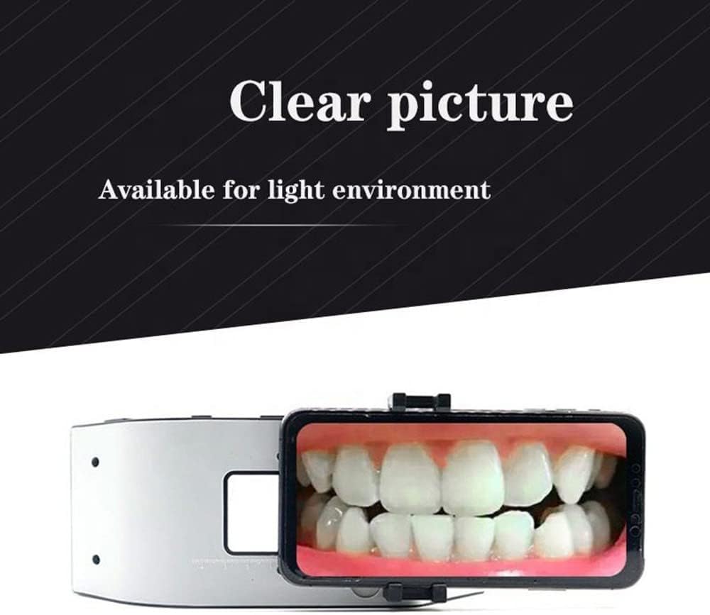 Mobilna Lampa Do Fotografii Stomatologicznej | Uchwyt Led Do Fotografii Stomatologicznej 6500k | Lampa Led Do Fotografii Stomatologicznej Do Fotografii Mobilnej | Sprzęt Do Fotografii Stoma