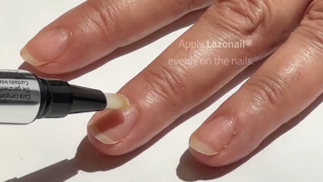 Lazonail Nail Strengthening & Repair Gel, Restores Brittle Nails