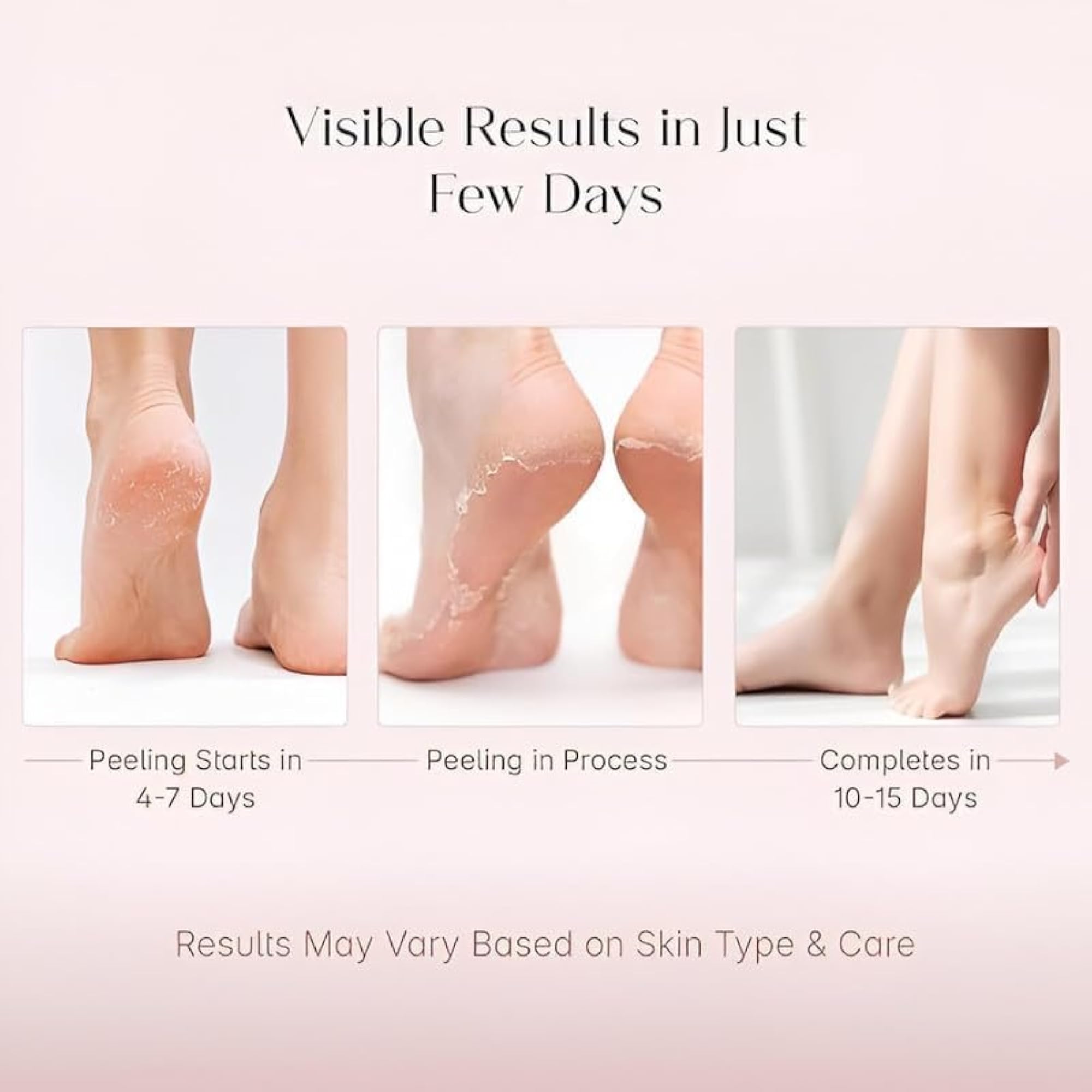 Peeling and Exfoliating Foot Mask for Soft Smooth Feet