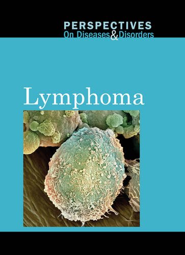 Lymphoma