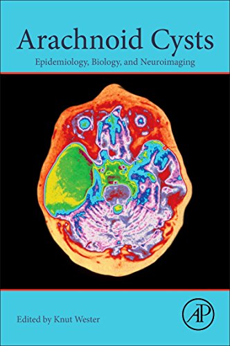 Arachnoid Cysts: Epidemiology, Biology, and Neuroimaging