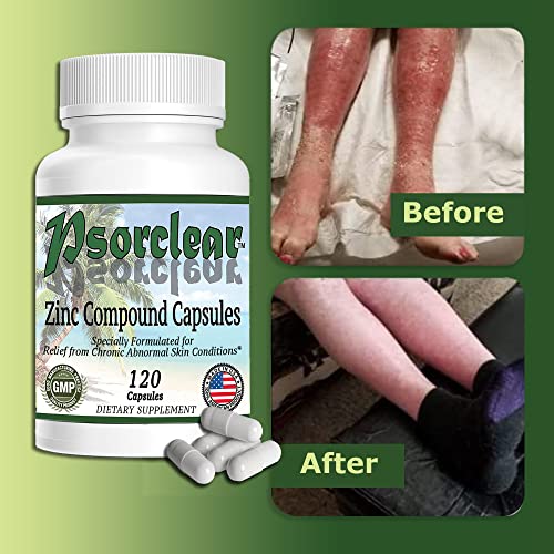 Psorclear-Psoriasis & Eczema Relief | A Proven Effective and All-Natural Product for Psoriasis Eczema & Rosacea Relief That Works - Rated One of The Best (120 Count Bottle) - Image 5