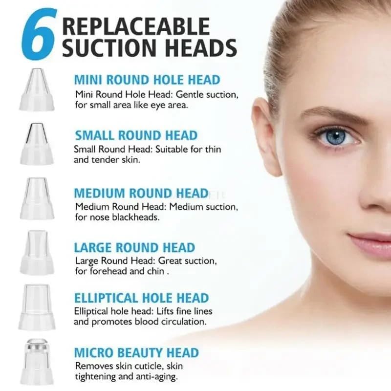 Image of Flying Monk Blackhead Remover, USB Rechargeable Pore Vacuum, Comedone Extractor with Strong Suction, Facial Deep Cleansing Device for Oily Normal Dry Skin