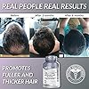 Foli-Tonic-DHT-Blocker-To-Stop-Hair-Loss-Hair-Thinning-Help-Thicker-Hair-Growth-Hair-Regrowth-Vitamin-Supplement-for-Men-and-Women-60-Vegan-Capsules Herbtonics Foli Tonic Hair Growth with Biotin - Hair Vitamins with DHT Blocker, Saw Palmetto, Beta Sitosterol - Promotes Hair Regrowth for Men & Women - Hair Loss Vitamins for Hair Care - 60 Capsules