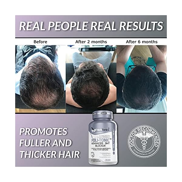 Foli-Tonic-DHT-Blocker-To-Stop-Hair-Loss-Hair-Thinning-Help-Thicker-Hair-Growth-Hair-Regrowth-Vitamin-Supplement-for-Men-and-Women-60-Vegan-Capsules Herbtonics Foli Tonic Hair Growth with Biotin - Hair Vitamins with DHT Blocker, Saw Palmetto, Beta Sitosterol - Promotes Hair Regrowth for Men & Women - Hair Loss Vitamins for Hair Care - 60 Capsules