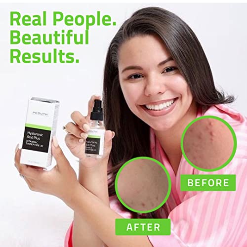 Hyaluronic Acid Plus Serum With Vitamin C Serum For Face, Hydrating Serum, Face Care For Wrinkles, Dark Spot & Dull Skin, Anti Aging Serum, Face Serum For Women & Men, Skin Care Product By Yeouth #TOP5