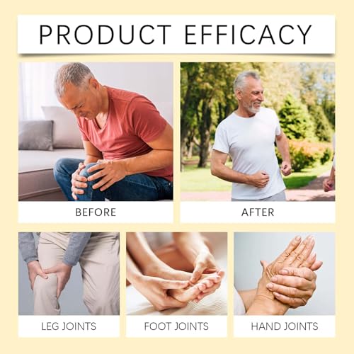 EONFAVE Bee Venom Bienengift Creme, 2 Stück Bienengiftsalbe, Bienengift Gelenkcreme, Natürlich Bienengiftsalbe Joint Gel für Rücken, Nacken, Knie, Deep Nourishment Beruhigend, Sanft Pflegend (120G)