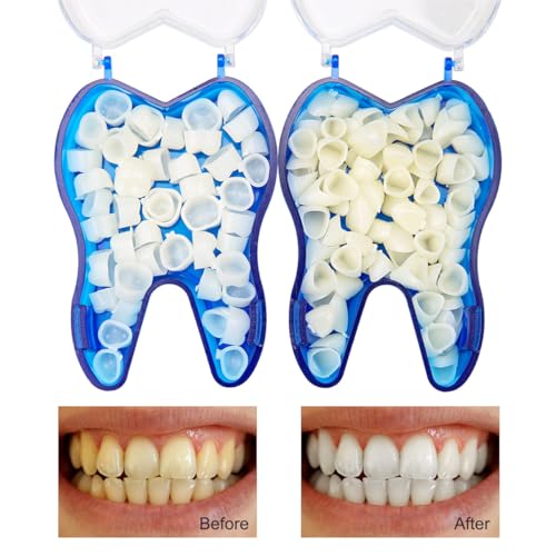 Image of Dental Temporary Crown Kit Anterior Front & Molar Posterior Mixed 100PCS | Whitening Protecting Molar Veneers 50 of Each