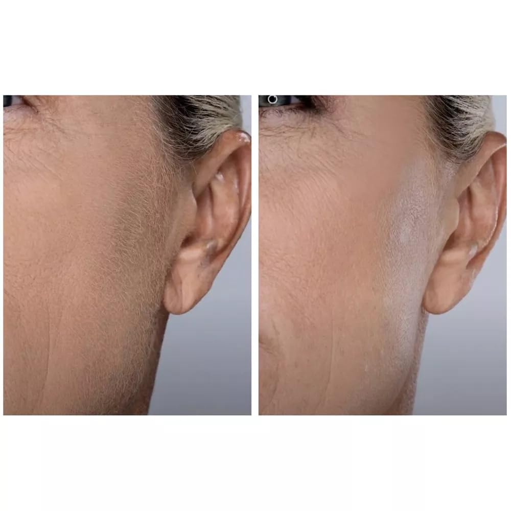 Spa Sciences SIMA DELUXE - Dermaplaning Tool for Painless Facial Exfoliation & Peach Fuzz Removal - 14 Weeks of Treatment Included