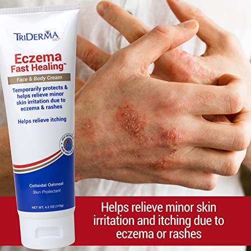 Image of TriDerma Fast Healing Eczema Cream for Adults, FSA Eligible, Colloidal Oats, AP4 Aloe Vera Gel, Vitamins, Eczema Relief Cream for Face & Body Itchy Skin & Rashes, No Cortisone or Fragrance - 4.2oz
