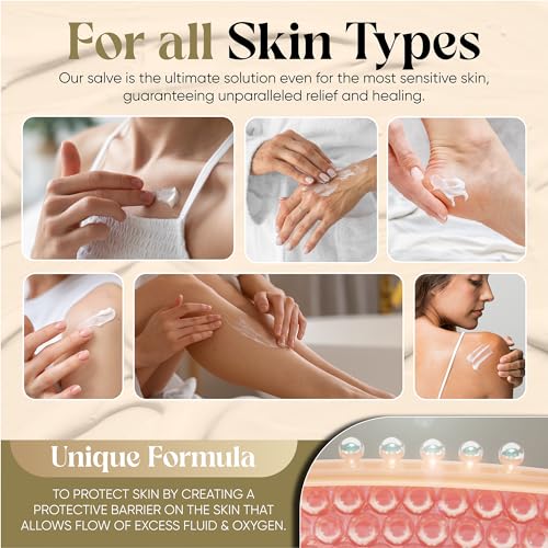 Manuka-Honig-Hanf-Salbe für Neurodermitis & Ekzeme, Schuppen - Propolis, Bienenwachs, Aloe Vera- Dermatologisch Empfohlen, Heilt Trockene, Rissige Haut