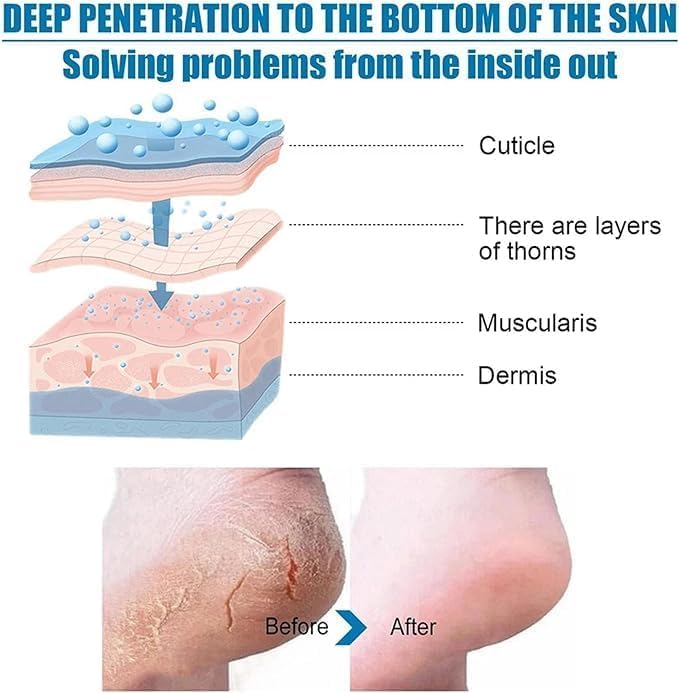 ELUYANI Foot Peel Mask For Dead Skin Removal Dry Cracked Callus Remover Hydrating Sock Deeply Moisturizes Dry & Dull Skin Reduces Pigmentation (PACK OF 2) 2