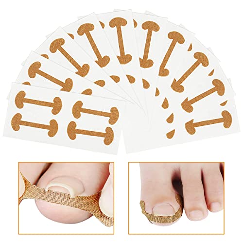 15 Pcs Toenail Corrector Strips, Ingrown Toe Nail Correction Tool, Toe Align Ingrown Nail Corrector Stickers for Nail Care
