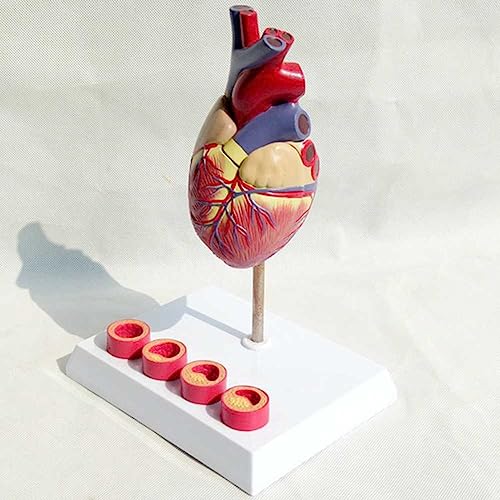 Modèle de cœur 3D AMITD à 2 pièces détachables pour simuler les thrombus - 6