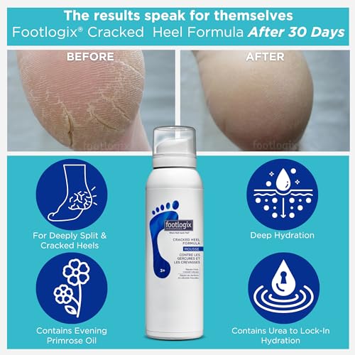 Footlogix Cracked Heel Formula Mousse 3+ 4.2 oz - Image 4