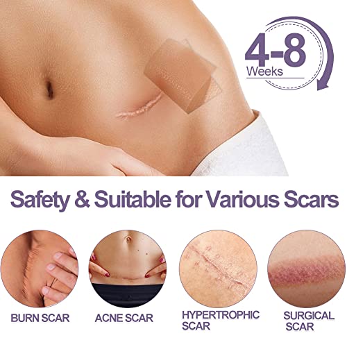 Narbenpflaster, Narbenpflaster Nach Op, Silikonpflaster für Narben, Silikon Narbenpflaster, Selbstklebende Narbenrolle… - Image 5