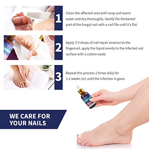 Nail Fungus Treatment, Toenail Fungus Treatment, Nail Repair Use At Home (1 Pcs) #TOP5