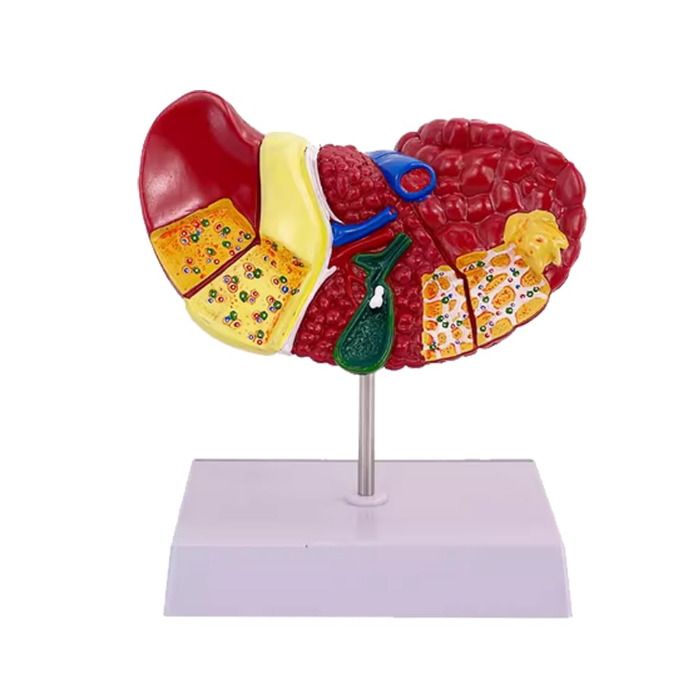 Medical Science Colored Pathology Liver Anatomical Model