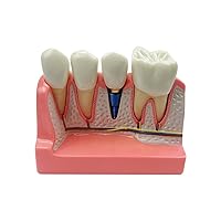 Vista 17 de Modelo de 28 dientes Typodont desmontables, modelo de dientes dentales modelo de enseñanza con goma suave para practicar y estudiar, con un