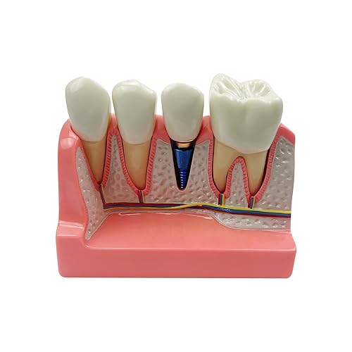 Miniatura 71 de 2 modelos de dientes estándar, modelo dental para adultos, modelo estándar de demostración de Typodont para niños, enseñanza dental, pantalla