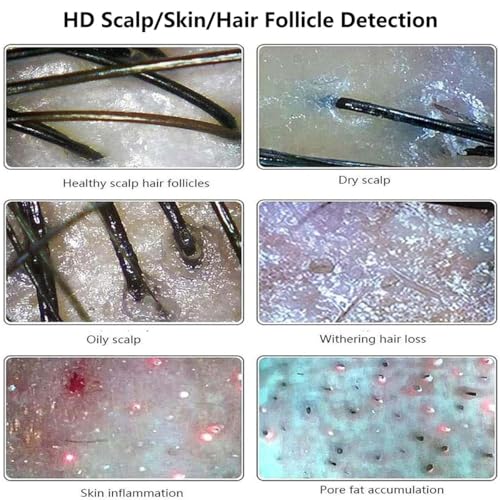 Machine d'analyse de cheveux et suivi de routine visage à la maison avec écran 11 pouces - 7