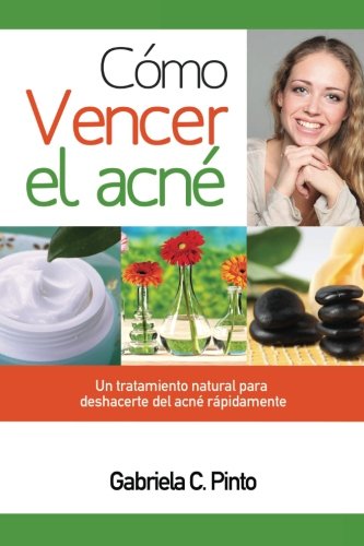 Cómo Vencer el Acné: Un tratamiento natural para deshacerte del acné rápidamente