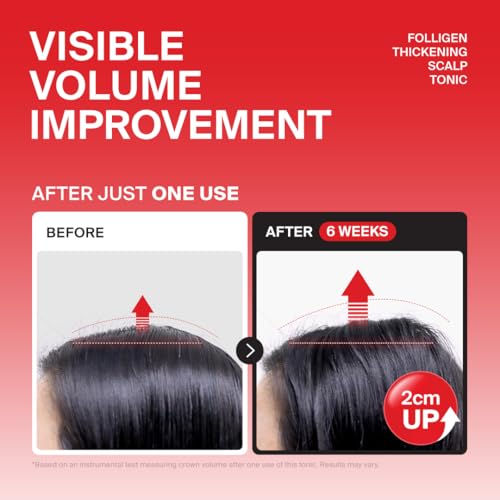 Image of Dr.FORHAIR Folligen Tonic 4.06 fl oz | Scalp Serum for Hair Care | Scalp Care and Nourishment | Revitalizing Tonic for Healthy Scalp & Hair Thickening