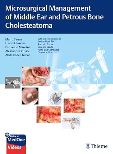 Microsurgical Management of Middle Ear and Petrous Bone Cholesteatoma (English Edition)