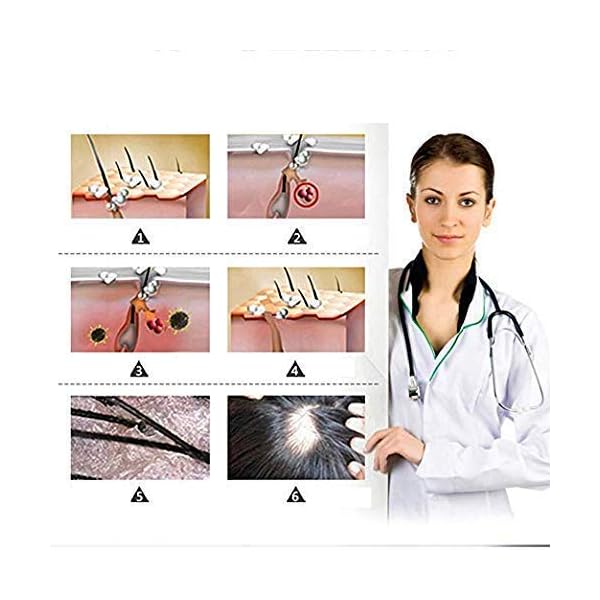 Hair-Growth-Oil2021-Hair-Growth-SerumHair-GrowthStops-Hair-Loss-Hair-Thinning-Treatment-Hair-Growth-TreatmentEssential-Oil-for-Women-Men-50ml Hair Growth Oil,2021 Hair Growth Serum,Hair Growth,Stops Hair Loss, Hair Thinning Treatment, Hair Growth Treatment,Essential Oil for Women Men-50ml…