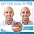Instant Smile Complete Your Smile Temporary Tooth Replacement Kit - Replace a missing tooth in minutes - Patented