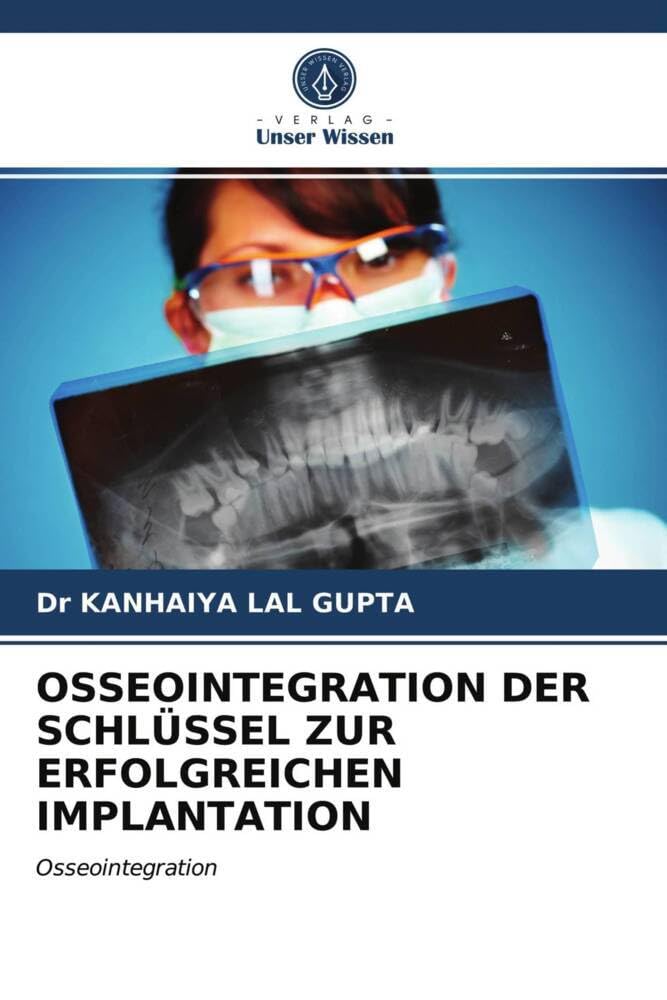 OSSEOINTEGRATION DER SCHLÜSSEL ZUR ERFOLGREICHEN IMPLANTATION: Osseointegration