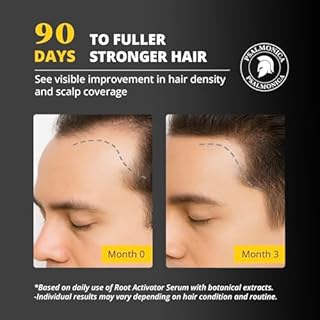 Root Activator Hair Serum: Natural Volume Enhancing Scalp Serum with Rosemary Oil for Stronger Hair & Soothing Scalp for Men & Women